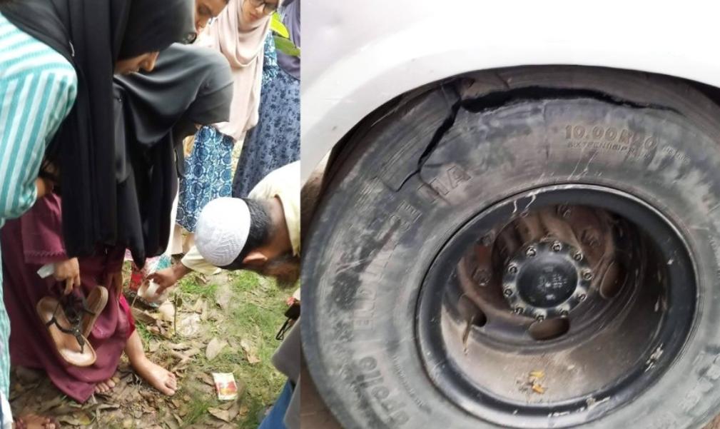 কুমিল্লা বিশ্ববিদ্যালয়ের স্টাফ বাস দুর্ঘটনা, ছাত্রী আহত