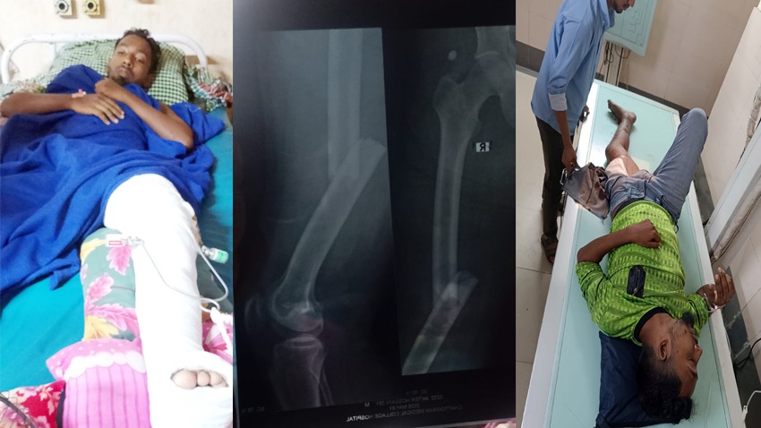 সড়ক দুর্ঘটনায় মোটরসাইকেল আরোহী আহত, চট্টগ্রামে জিডি দায়ের